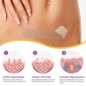 Oveallgo® Hyaluronic Acid Nano Microneedle Repair Tape