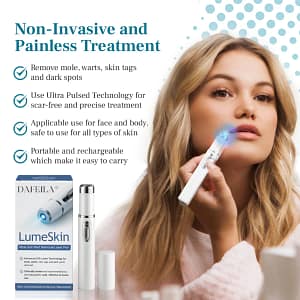DAFEILA® LumeSkin Mole and Wart Removal Laser Pen