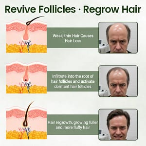 Timilk® Follicure BioGrow Hair Restoration Spray