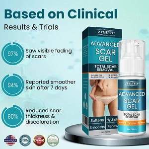 Zvoevo® Advanced Scar Gel
