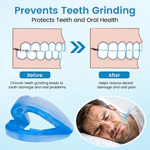 QIAWI™ DreamGuard: Anti-Snoring & Teeth Grinding Mouthpiece