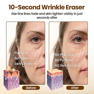 Biancat® Liftora 10s Wrinkle Serum