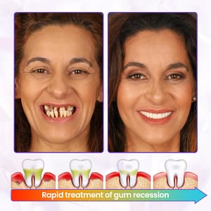 BBOJI® BeeRenew Advanced Gum Healing Toothpaste