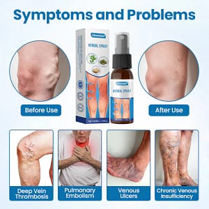 Glowrizon® VeinGuard Herbal Spray