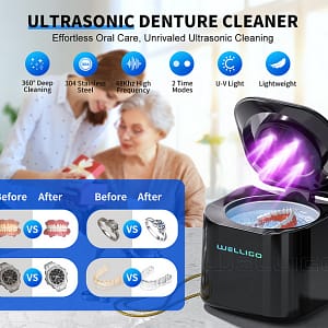 ROSOPLTM – Immediate Dentures