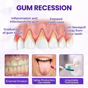 BBOJI® BeeRenew Advanced Gum Healing Toothpaste