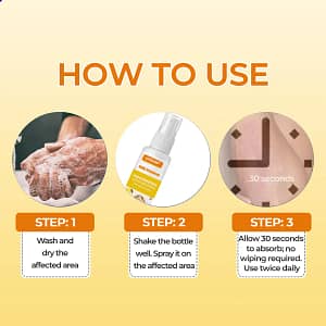 LOVILDS® Hemorrhoids Bee Poison Soothing Spray