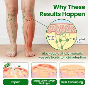 Timilk® VenoLift Leg Relief Spray