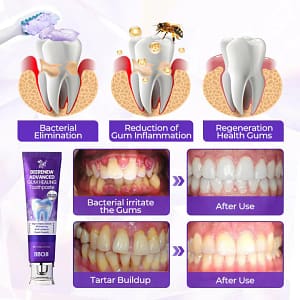 BBOJI® BeeRenew Advanced Gum Healing Toothpaste