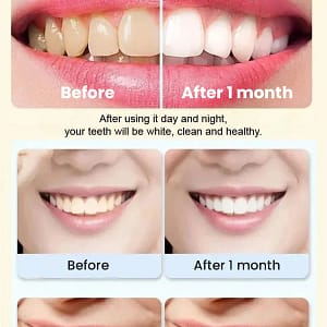 Probiotic Rapid Whitening Toothpaste