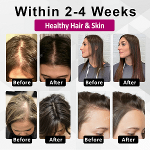 ATTDX® ThickHer Hair VitaGrowth Capsules