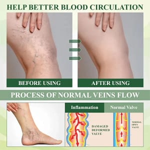 Fivfivgo® EdemaFree Flow Drain Massage Cream