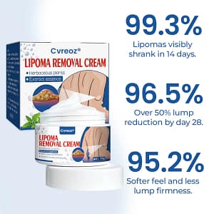 Cvreoz® Lipoma Removal Cream