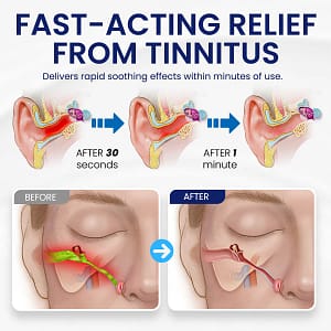 NEGUSY™ Tinnitus Relief Drops