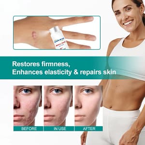 Fade scars fast with ScarRemove™ Advanced Spray—hydrates, smooths, and restores skin from surgery, burns, or stretch marks naturally.