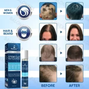 Rolimey® STEM Cell Hair Cycle Roller