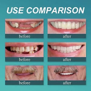 BQYOOM™ Premium Dentures
