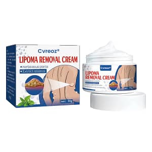 Cvreoz® Lipoma Removal Cream