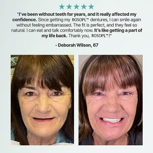 ROSOPLTM Custom-Fit Full Functional Dentures