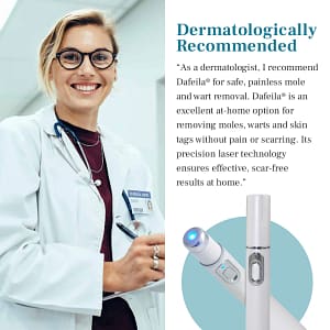 DAFEILA® LumeSkin Mole and Wart Removal Laser Pen