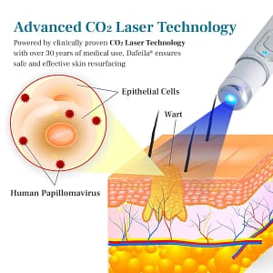 DAFEILA® LumeSkin Mole and Wart Removal Laser Pen