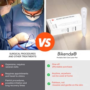 Bikenda® Portable Skin Care Laser Pen