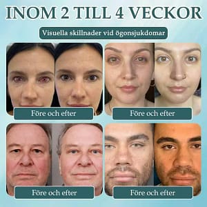 Spzv®Opti Fusion Nano Eye Drops