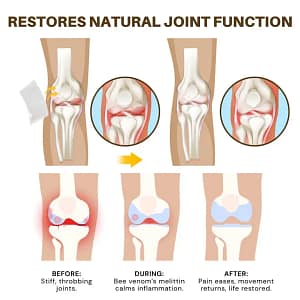 NovaRX® Bee Venom Joint Therapy Botanical Patch