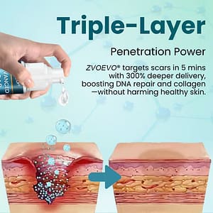 Zvoevo® Advanced Scar Gel for Surgical Scars