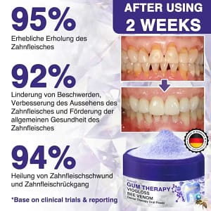 Rolimey® VioGloss Bienengift-Zahntherapie Oral Power