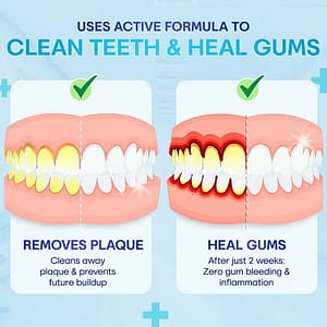 BQYOOM™ Gum Therapy Agent