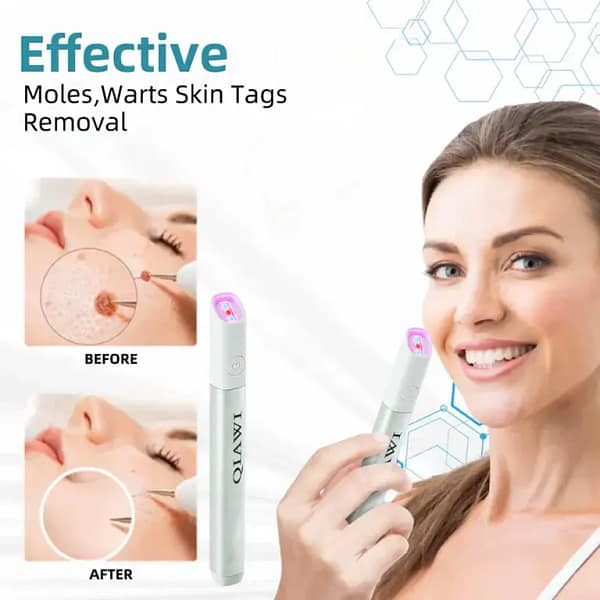 QIAWI™ All-in-One CO₂ Laser Eraser Pen | Removes Moles, Warts, Skin