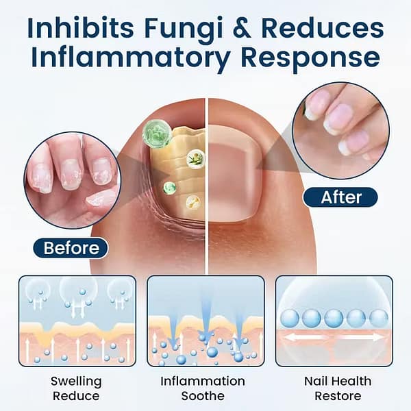 Fivfivgo® OnyxiGuard Fungal Repair Herbal Spray