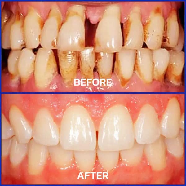 Rolimey® VioCore Bee Venom Dental Gum Therapy Toothpaste