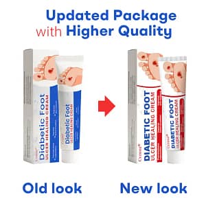 Cvreoz® Diabetic Foot Ulcer Healing Cream