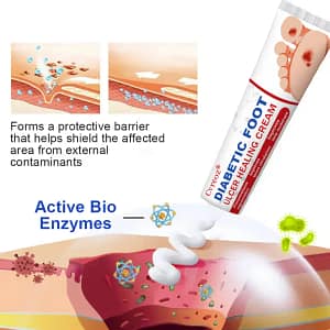 Cvreoz® Diabetic Foot Ulcer Healing Cream
