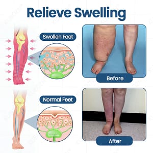 KUBOZN® Roll-On Pump Cream for Lymphatic Drainage & Swelling Relief