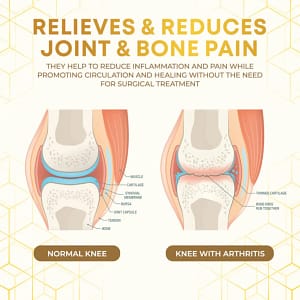 Seurico™ Bee Venom Joint Therapy Pain Relief Gel