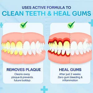 Negusy™ Gum Therapy Agent