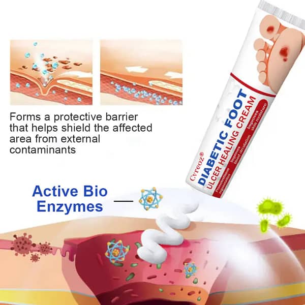 Cvreoz® Diabetic Foot Ulcer Healing Cream