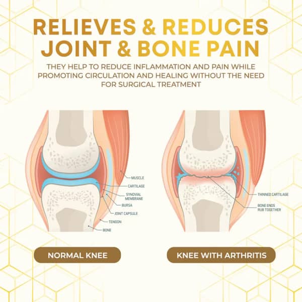 Seurico™ Bee Venom Joint Therapy Pain Relief Gel