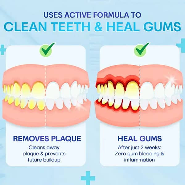 Negusy™ Gum Therapy Agent
